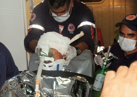 Homem tem faca cravada em seu crânio durante bebedeira no Piauí